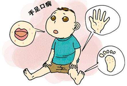春意盎然，勿忘防治手足口